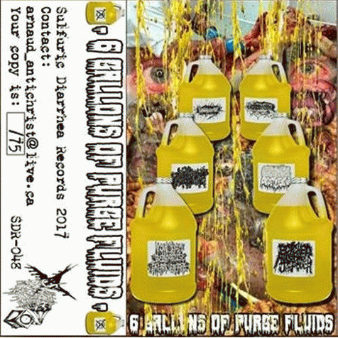 Botched Anastomosis J-Pouch : 6 Gallons of Purge Fluids